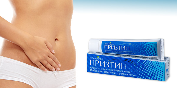 stretch mark cream